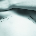 Shining the light and getting the message on breast reconstruction