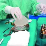 Experts dispute conclusions of PIP breast implant scandal investigation