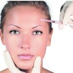 Relax and recontour in facial aesthetics: a long-term follow-up