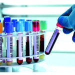 Lipoic acid helps restore and synchronise the ‘biological clock’