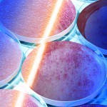 Effect of laser radiation on MMP gene expression in keratinocytes
