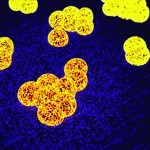 Increase in MRSA prompts updated IDSA guidelines for skin and soft tissue infection