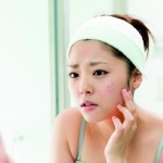 Acne in adult women: more common and more frustrating