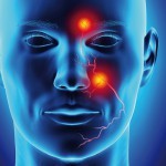 Reversal of a dermal filler induced facial artery occlusion
