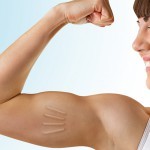Hormone pellet therapy as a hormone replacement method