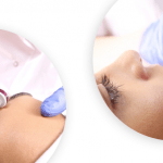 Microneedling in the medical and cosmetic field