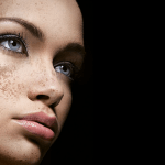 Combination treatments for melasma
