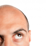 Popular Hair Transplant Procedures