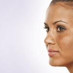 Melasma aetiology and treatment review