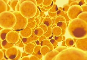 Autologous fat grafting