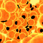 Autologous fat grafting