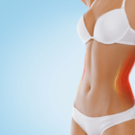 Body shaping with SculpSure® non-invasive laser treatment