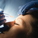 ‘Botox’ improves appearance of facial scars in reconstructive surgery