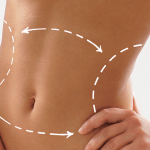 Nip, tuck or fill: 31% of Brits are interested in having cosmetic surgery in the future