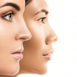 Mapping of intrinsic and extrinsic ageing in Asian and Caucasian women