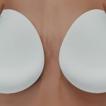 Allergan Suspends Sales and Withdraws Supply of Textured Breast Implants in European Market