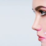 The Use of Absorbable Sutures for Suspension and Volumising