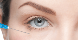 Periorbital Rejuvenation with Hyaluronic Acid Fillers