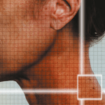 Photo Rejuvenation More Than a Facial Treatment