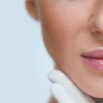 The non-surgical lip lift with tubercle shifts