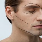 Facial plastic surgery in men enhances perception of attractiveness, trustworthiness