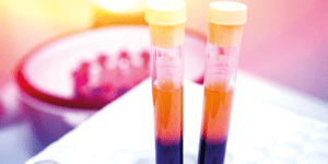 Thermal conditioning improving PRP growth factor content