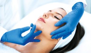 Hyaluronic Acid Threads for skin improvement