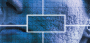 COMBINATION OF FULL AND FRACTIONAL CO<sub>2</sub> RESURFACING FOR ATROPHIC ACNE SCARRING
