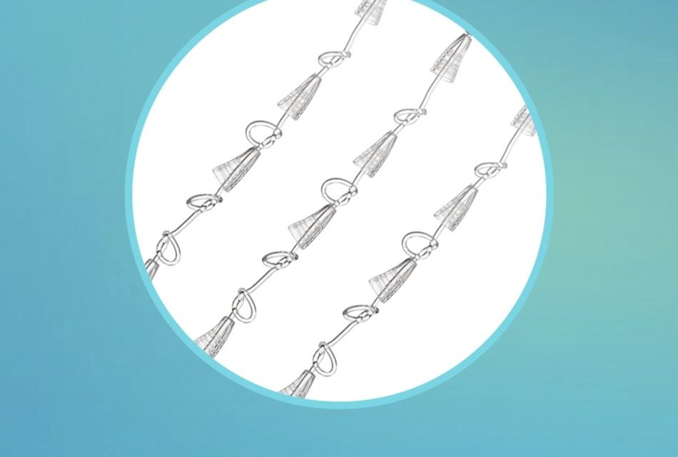 Suneva Medical to distribute Silhouette Instalift® sutures in North America