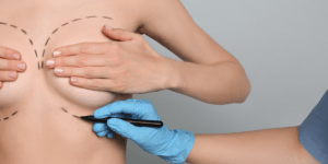 Latest Global Survey from ISAPS Reports Continuing Rise in Aesthetic Surgery Worldwide