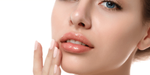 Clinical study shows high level of patient satisfaction with Restylane® Kysse™